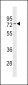 ESR1 isoform1 Antibody(N-term)
